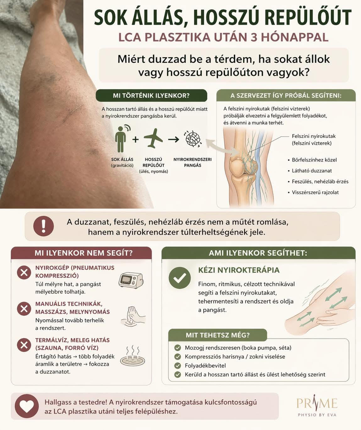 Infografika LCA plasztika utáni duzzanatról, hosszú állásról, repülőútról és rehabilitációs teendőkről